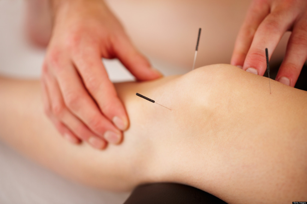 Acupuncture treatment needling