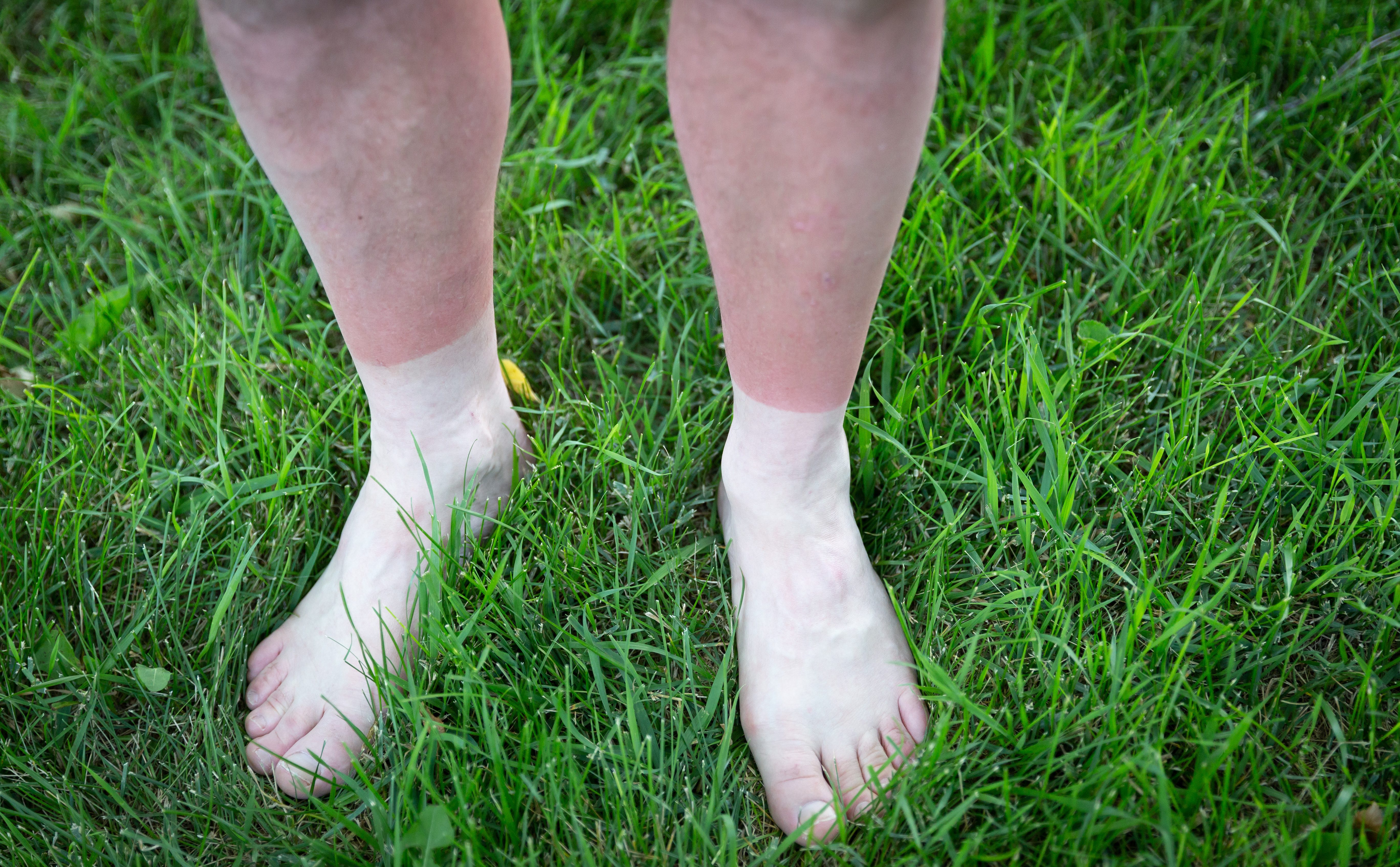 The 6 quintessential runner tan lines - Canadian Running Magazine